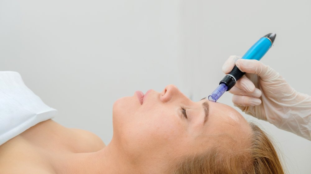 What you should know before you try microneedling