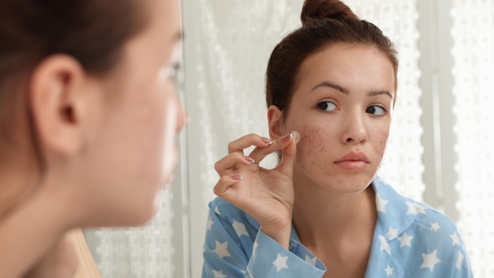 Do pimple patches really work?