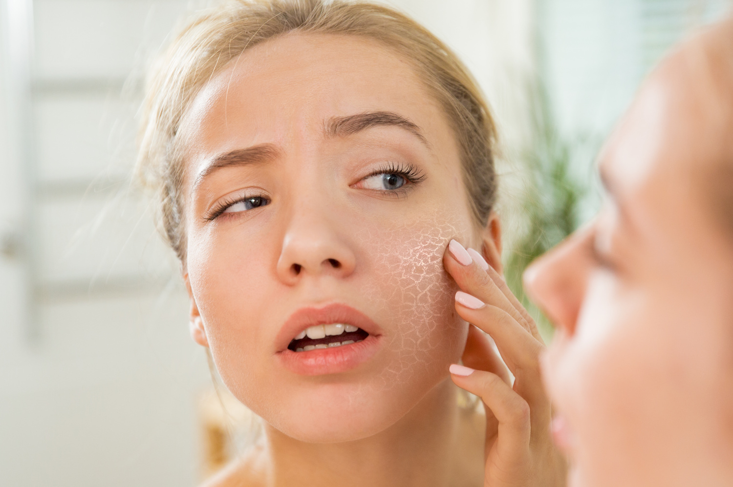 Why Use Natural Moisturizers For Dry Skin